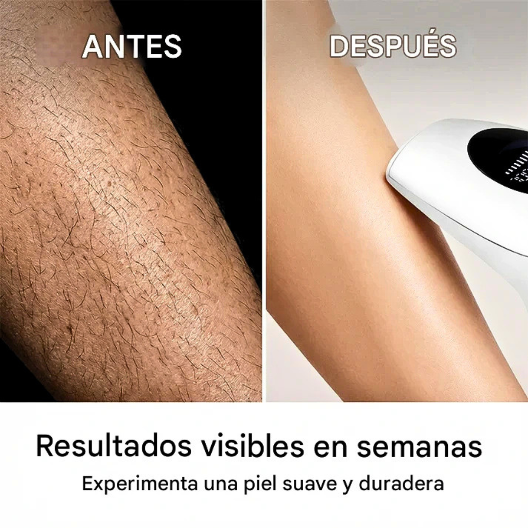 LumiSilk Pro – Depiladora IPL Láser en Casa