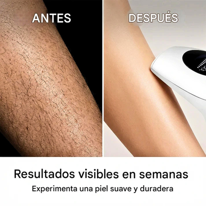 LumiSilk Pro – Depiladora IPL Láser en Casa